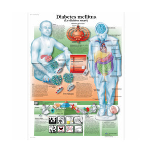 Planche anatomique - Le diabète - Anatomie et pathologie - My Podologie